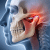 jaw pain